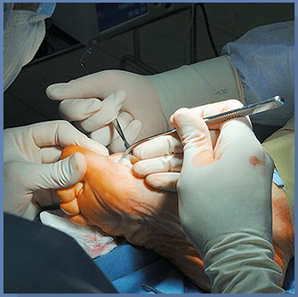 Operazione