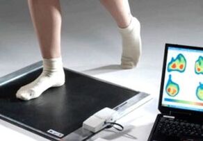 Diagnosi dell'alluce valgo