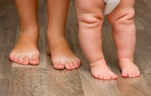 Valgo Deformazione del piede nei bambini